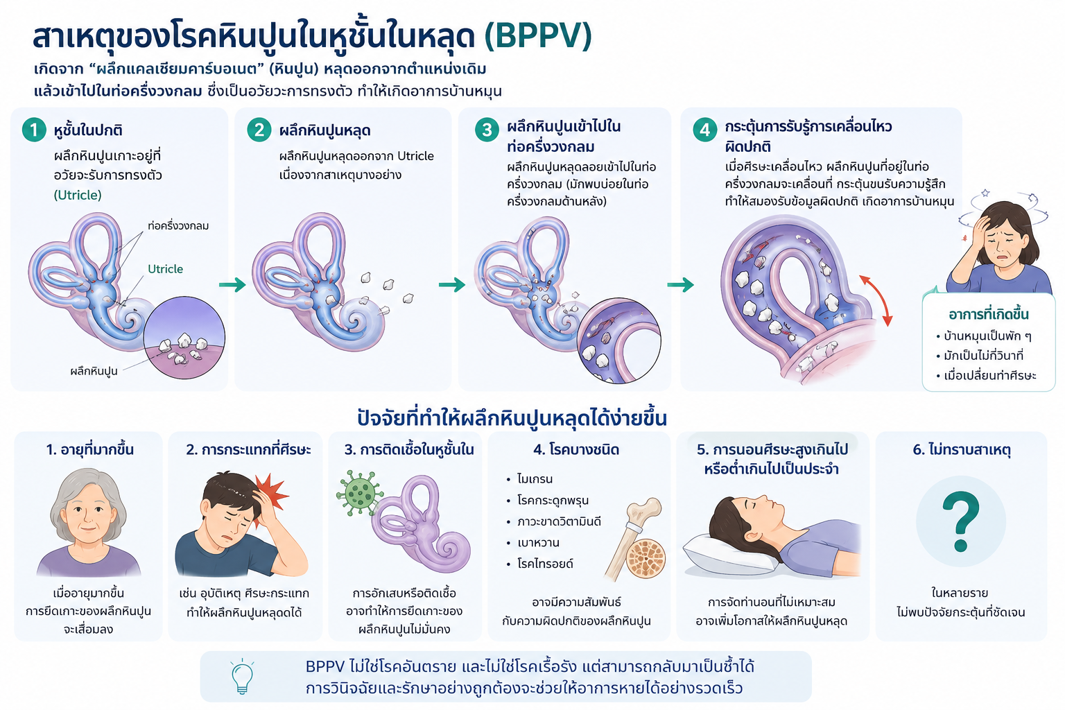 โรคหินปูนในหูชั้นในหลุด (BPPV)